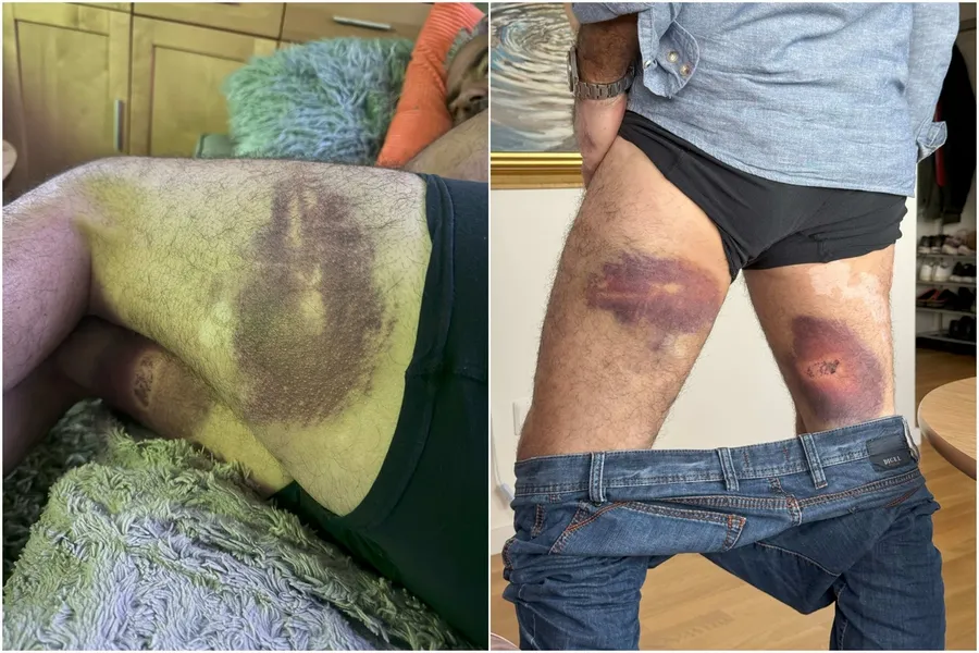 Polis åtalas för flera fall av misshandel under festival i Åmål